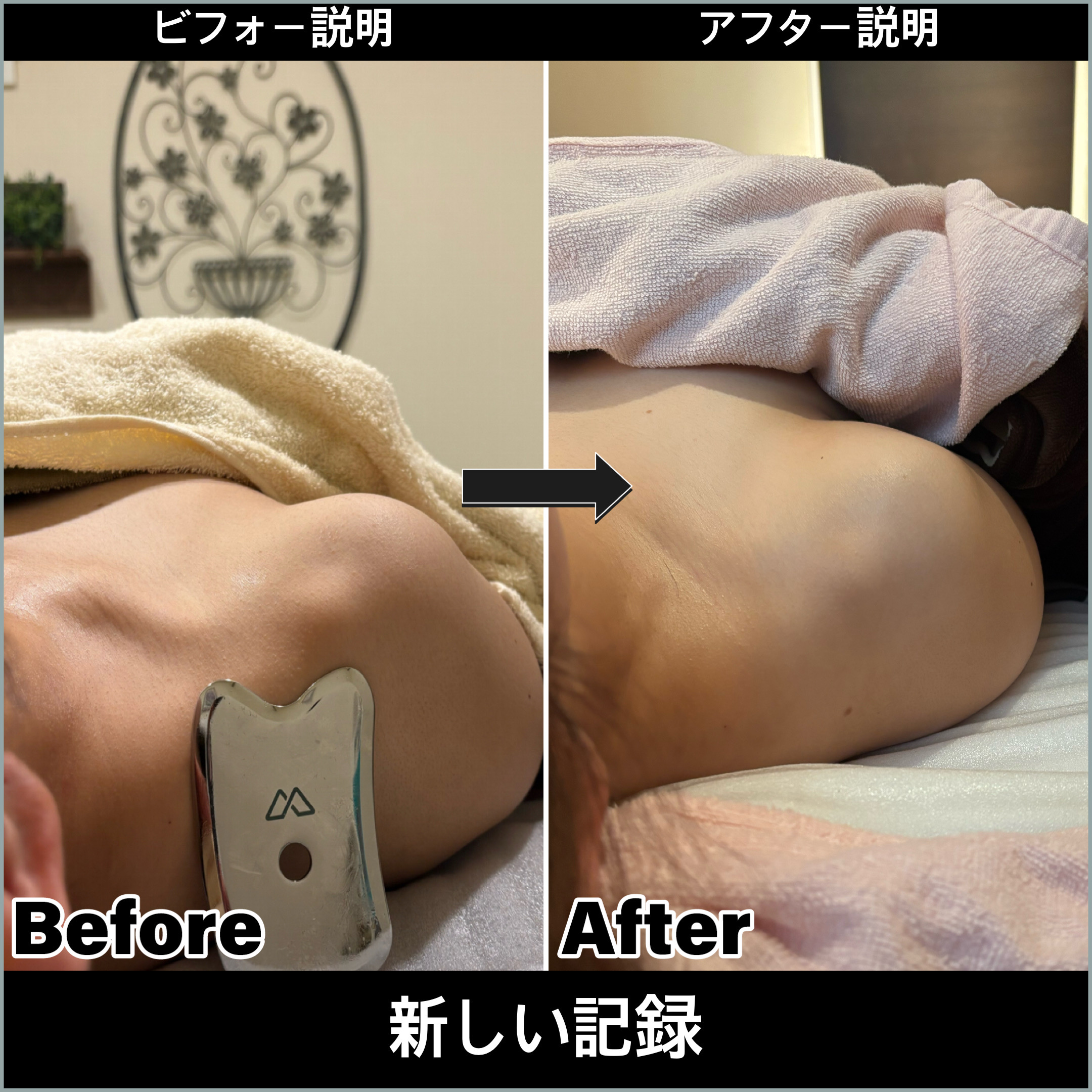 小顔・肌質改善ビフォーアフター